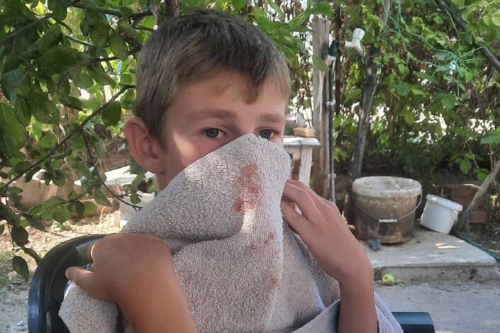 Opet pretučen srpski dečak na KiM, snage KBS-a ušle u srpske sredine „da podele maske“